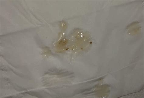 Brown Chunks in Semen : r/medical_advice