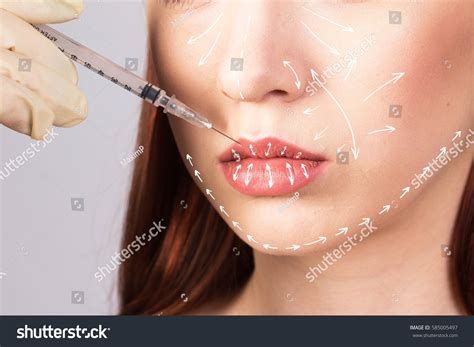 Image result for Cellulite Injection