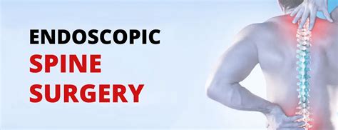 Endoscopic Spine Surgery