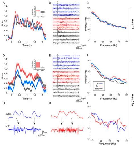 Vision | Special Issue : Role of the Pulvinar in Visual Processing