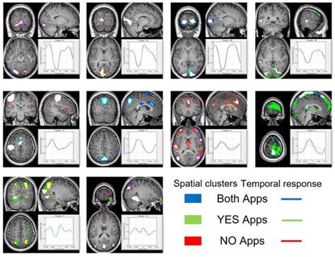 Visualization of the Dynamic Brain Activation Pattern during a Decision ...