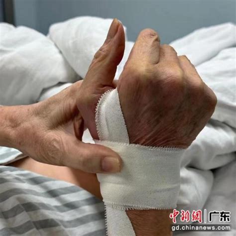 广东医院实施“脑梗”新疗法：经手部放支架——中国新闻网·广东