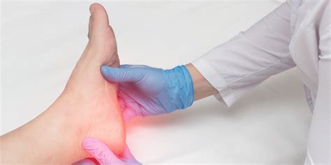 Plantar Fasciitis | Cortisone Injections | RAD Clinics