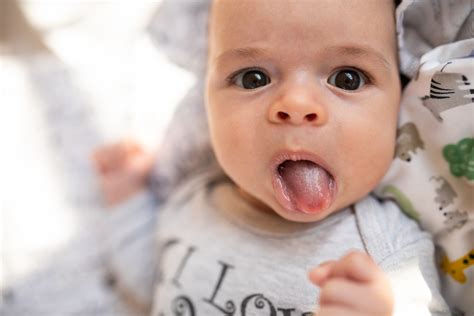 Does Your Baby Need Tongue-Tie Clipping? | University of Utah Health