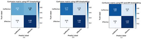 A Nasal Resistance Measurement System Based on Multi-Sensor Fusion of ...