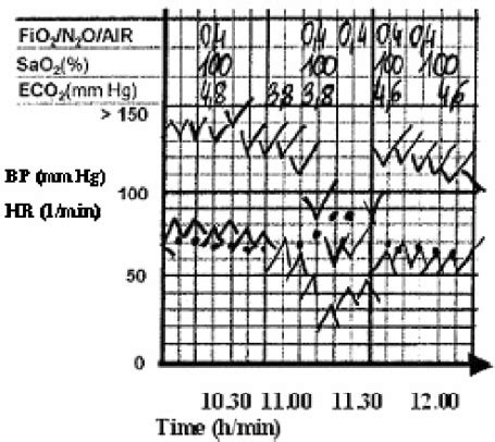 Image result for Anesthesia FiO2 Calculation