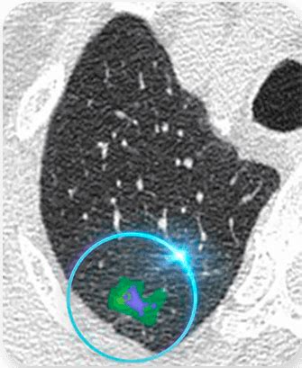 Nura Ai Health Screening Center Hyderabad