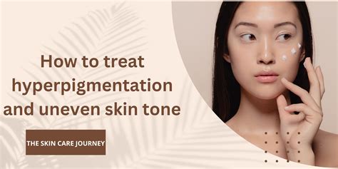 How to treat hyperpigmentation and uneven skin tone