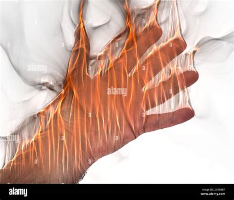 Image result for Exploding Orange Hand Injury