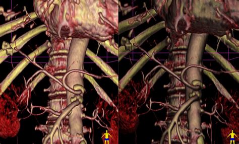 Image result for Python Remove Scan Shadows