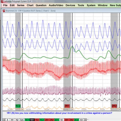 Image result for Polygraph Test Screen