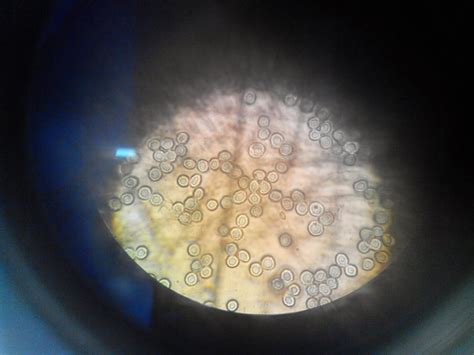 Cuaderno de prácticas HEMATOLOGIA: DETECCIÓN DE CUERPOS DE HEINZ ...