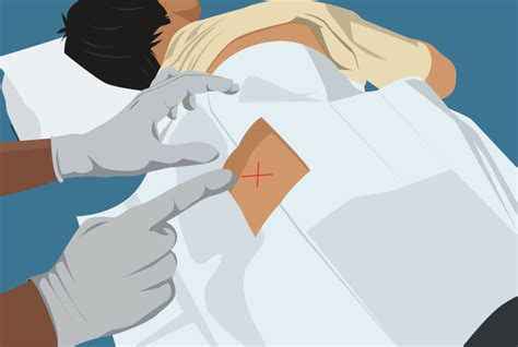 Bone Marrow Testing 的图像结果