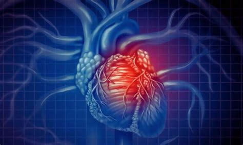 CKD predicts incomplete revascularization and subsequent MACE in CCS ...