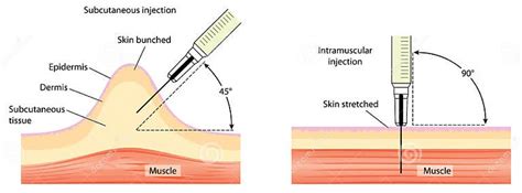Injection 的图像结果