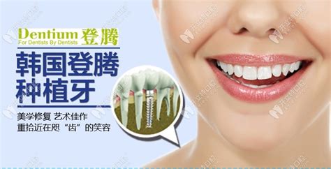 分享韩国登腾dentium种植体型号尺寸大全，了解您的种植牙的价格_皓齿口腔网