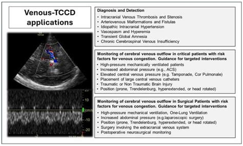 Transcranial Color Doppler for Assessing Cerebral Venous Outflow in ...
