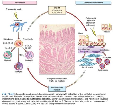 Pathophysiology of Bronchial Asthma - What happens in asthma - HubPages