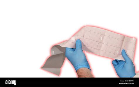 Cardiogram Procedure 的图像结果