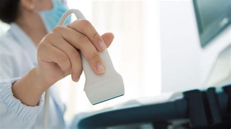 Ultrasound 的图像结果