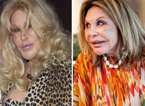 Plastic Surgery Disasters 的图像结果