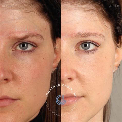 Facial Reconstruction Before & Afters | Dr. Jonathan Cabin