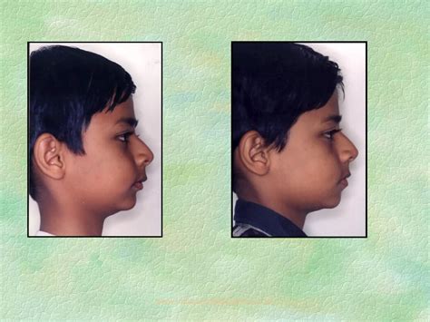 Image result for Vto Core Target