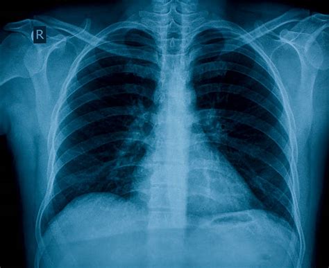 Govt Hospital Asks Patients To Click Photos Of X-Rays