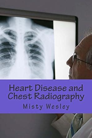 Heart Disease and Chest Radiography eBook : Wesley, Misty: Amazon.in ...