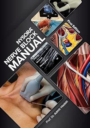 NYSORA Nerve Block Manual: First Edition eBook : Hadzic, Admir: Amazon ...