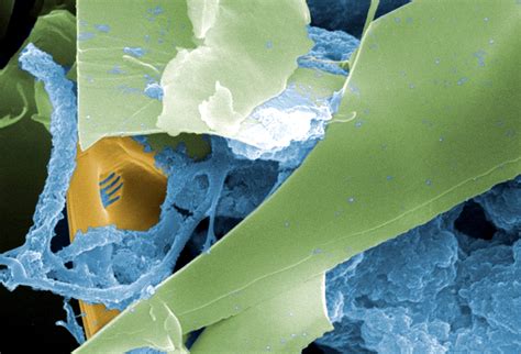 Scanning Electron Micrograph 的图像结果