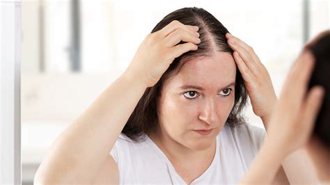 The Best Hair Loss Treatments for Women - GoodRx