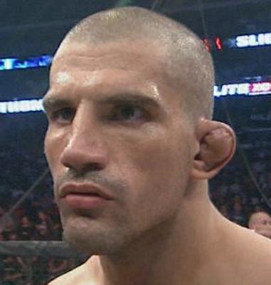 Bildergebnis für worst cauliflower ear ever