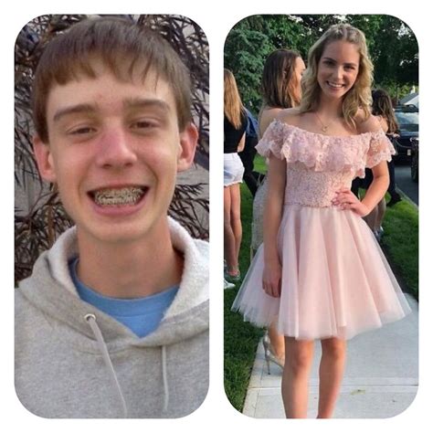 Image result for Transgender Guys Transition