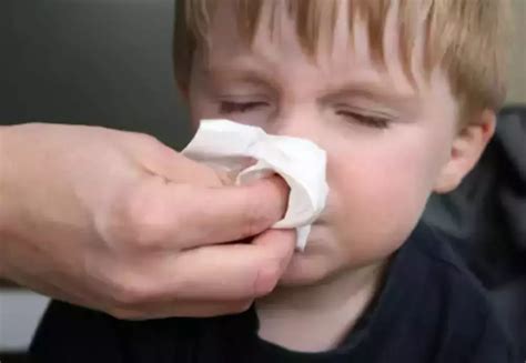 婴儿流鼻血是什么原因引起的（孩子经常流鼻血是因为患上白血病）-幼儿百科-魔术铺
