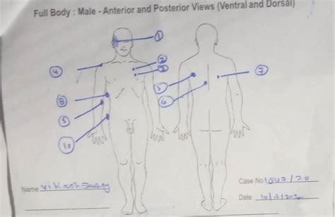 देखिए विकास दुबे की पोस्टमॉर्टम रिपोर्ट, कहां-कहां है जख्म, कहां से पार ...