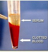 blood serum 的图像结果