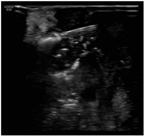 Diagnostics | Special Issue : Imaging-Guided Techniques in ...