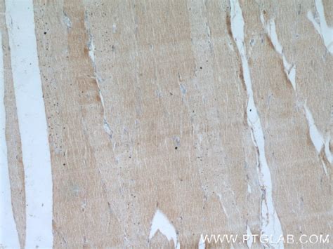 NUBP2 antibody (15409-1-AP) | Proteintech