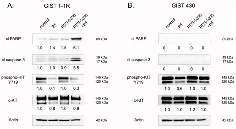 Claudin-1 Contributes to Gastrointestinal Stromal Tumors (GIST ...