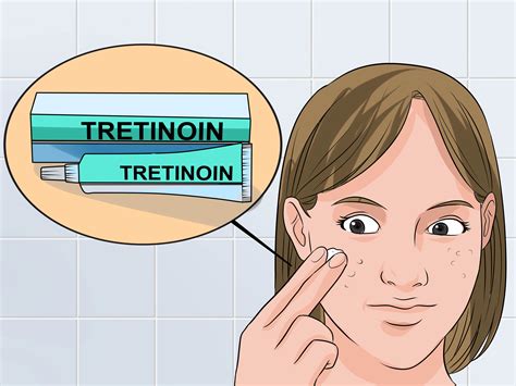 How to Use Tretinoin and Benzoyl Peroxide Concurrently