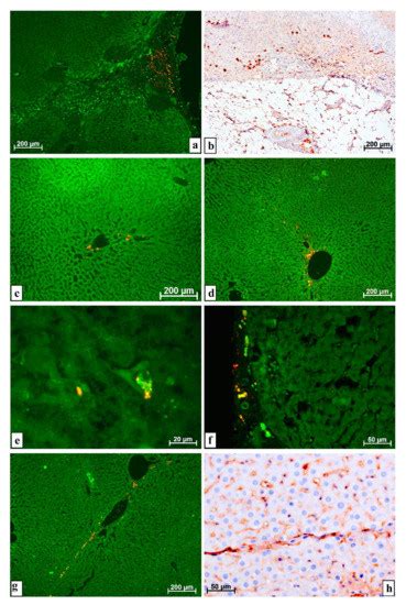 Some Special Aspects of Liver Repair after Resection and Administration ...
