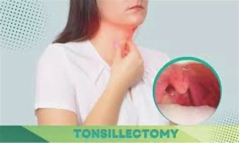 Carbon Dioxide Laser Tonsillotomy Offers Effective, Cost-Efficient ...