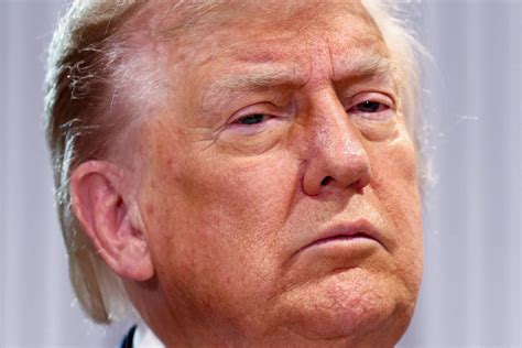 Trump now faces the same terrible choice | Opinion