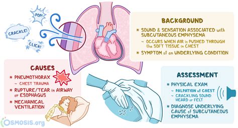 Crepitus in Lungs and Crackling Breath Sounds | Osmosis