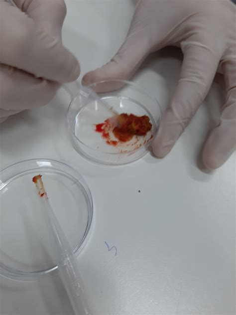 Cuaderno de prácticas bioquímica: Sangre oculta en heces