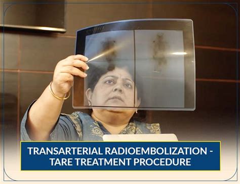 Nuclear Medicine Therapy in India - Alpha PSMA Therapy, Lu PSMA Therapy ...