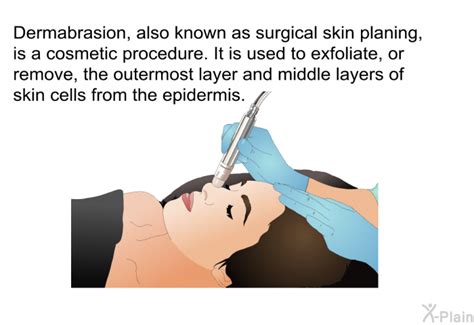 Image result for Derma Procedure