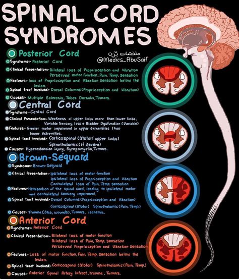 Spinal Cord Syndromes: Causes and Symptoms | 𝐑𝐚𝐯𝐢𝐧𝐝𝐞𝐫 𝐊. posted on the ...