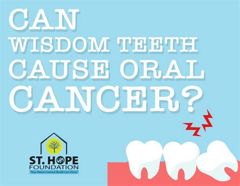 Can Wisdom Teeth Cause Oral Cancer? | St. Hope Foundation